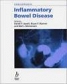 Challenes in Inflammatory Bowel Disease