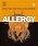 Allergy 3e
