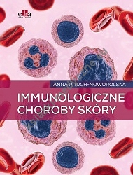 Immunologiczne choroby skóry