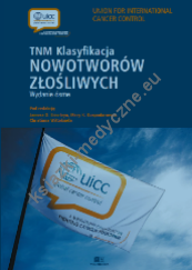 TNM. Klasyfikacja nowotworów złośliwych. Wydanie 8