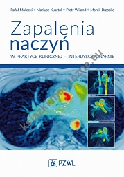 Zapalenia naczyń w praktyce klinicznej interdyscyplinarnie