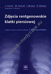 Zdjęcia rentgenowskie klatki piersiowej