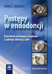 Postępy w endodoncji  Powtórne leczenie kanałowe i zabiegi chirurgiczne.