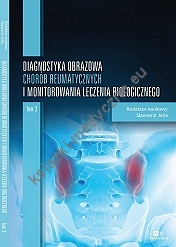 Diagnostyka obrazowa chorób reumatycznych i monitorowania leczenia biologicznego. Tom III