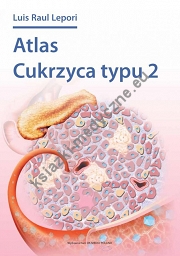 Atlas cukrzycy typu 2