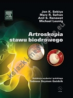 Artroskopia stawu biodrowego