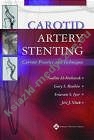 Carotid Artery Stenting Current Practice & Techniques