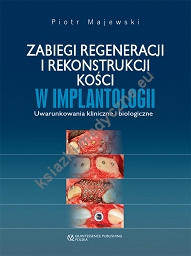 Zabiegi regeneracji i rekonstrukcji kości w implantologii