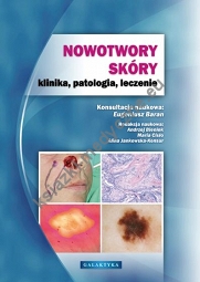 Nowotwory skóry klinika, patologia, leczenie