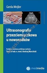 Ultrasonografia przezciemiączkowa u noworodków