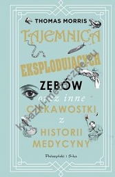 Tajemnica eksplodujących zębów oraz inne ciekawostki z historii medycyny