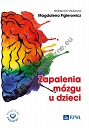 Zapalenia mózgu u dzieci