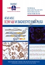 Atlas IASLC Oceany ALK w diagnostyce rola płuca