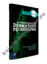 Autoimmunizacyjne dermatozy pęcherzowe