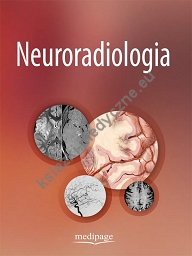 Neuroradiologia