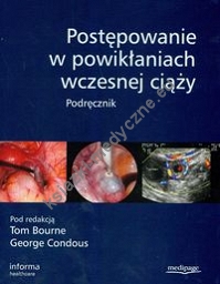 Postępowanie w powikłaniach wczesnej ciąży