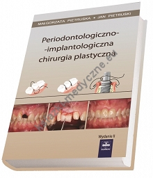 Periodontologiczno-implantologiczna chirurgia plastyczna