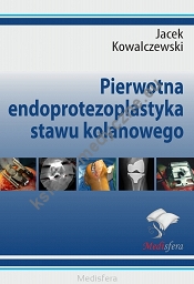 Pierwotna endoprotezoplastyka stawu kolanowego