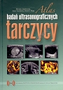 Atlas badań ultrasonograficznych tarczycy