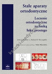 Stałe aparaty ortodontyczne. Leczenie ortodontyczne techniką łuku prostego