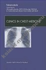 Tuberculosis An Issue of Clinics in Chest Medicine