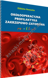 Okołooperacyjna profilaktyka zakrzepowo-zatorowa – pisane kolorem