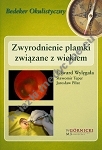 Zwyrodnienie plamki związane z wiekiem