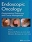 Endoscopic Oncology