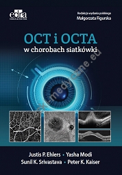 OCT i OCTA w chorobach siatkówki