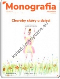 Monografia Choroby skóry u dzieci