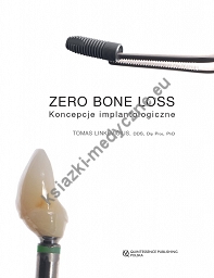 Zero Bone Loss - Koncepcje Implantologiczne