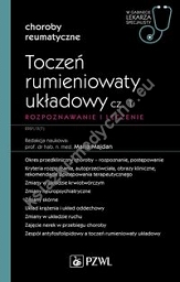 Toczeń rumieniowaty układowy Część 1 Rozpoznawanie i leczenie