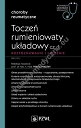 Toczeń rumieniowaty układowy Część 1 Rozpoznawanie i leczenie