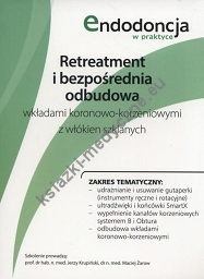 Retreatment i bezpośrednia odbudowa wkładami koronowo-korzeniowymi z włókien szklanych