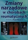 Zmiany narządowe w chorobach reumatycznych