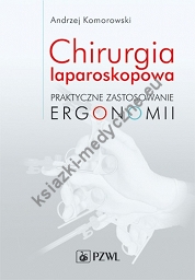 Chirurgia laparoskopowa Praktyczne zastosowanie ergonomii