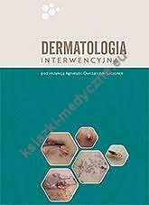 Dermatologia interwencyjna 
