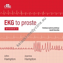 EKG to proste