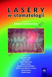 Lasery w stomatologii