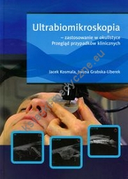 Ultrabiomikroskopia - zastosowanie w okulistyce