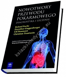 Nowotwory przewodu pokarmowego. Diagnostyka i leczenie