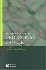 Treatment Options in Urological Cancer