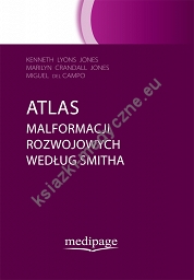 Atlas malformacji rozwojowych według Smitha