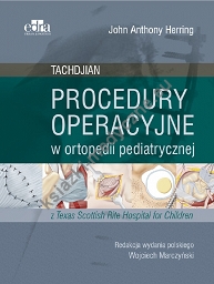 Procedury operacyjne w ortopedii pediatrycznej. Tachdjian