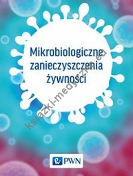 Mikrobiologiczne zanieczyszczenia żywności