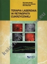 Terapia laserowa w retinopatii cukrzycowej