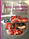Zabiegi augmentacyjne w implantologii