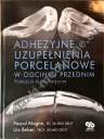 Adhezyjne uzupełnienia porcelanowe w odcinku przednim