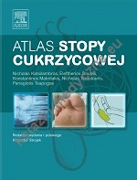 Atlas stopy cukrzycowej