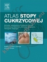 Atlas stopy cukrzycowej